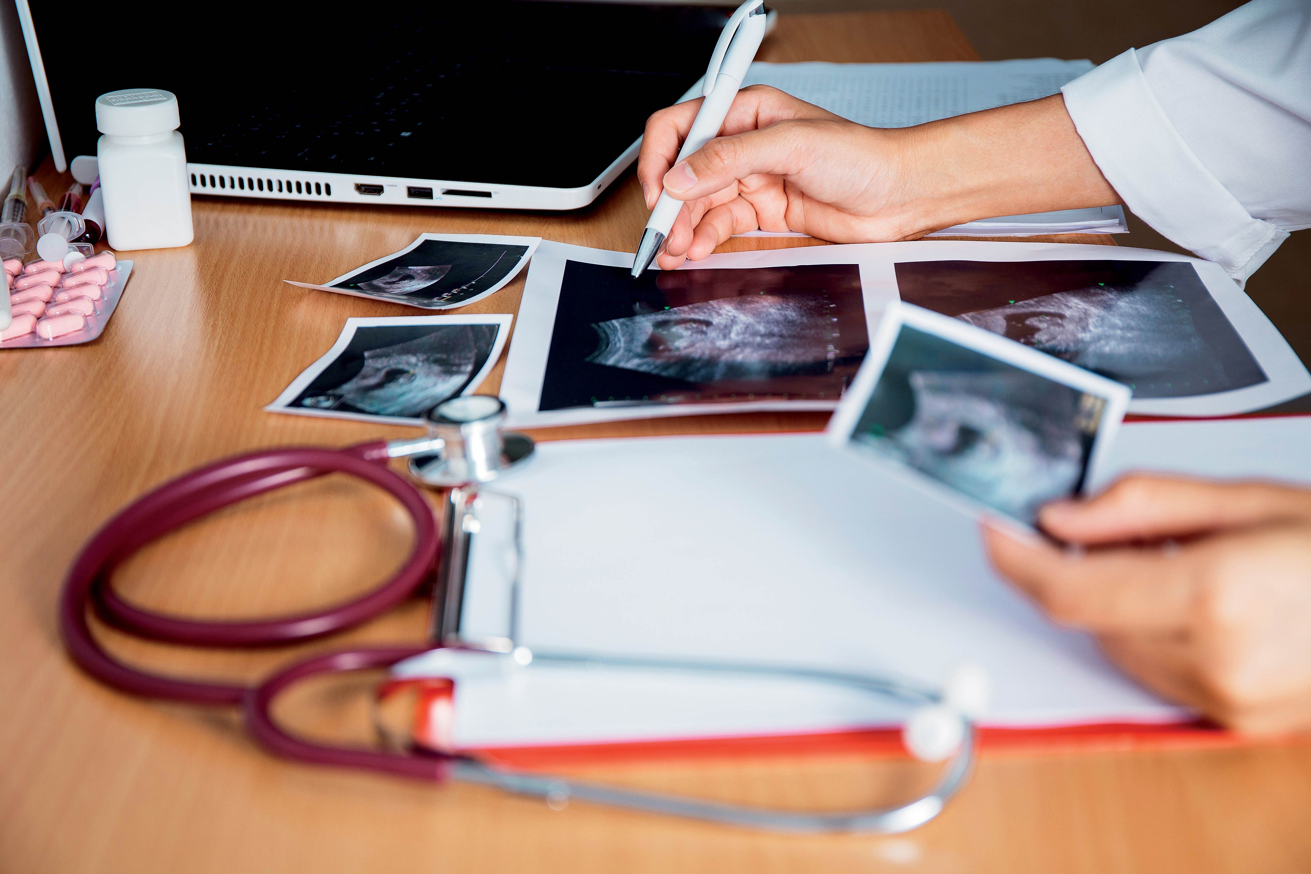 Miroslav Verner: K úspěšnosti vyšetření může přispět i samotná žena